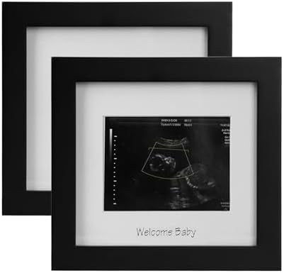 IHEIPYE Baby Sonogram Photo Frame 2Pack 1