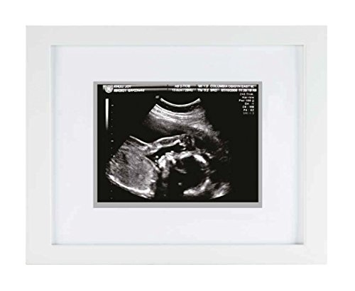 Pearhead Sonogram Frame White Shadowbox Baby Keepsake
