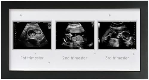 Triple Ultrasound Frame for Pregnancy Memories