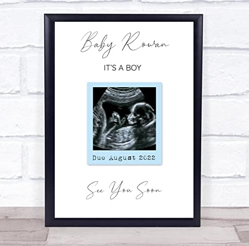 Baby Scan Picture Photo Pregnancy Gender Reveal Keepsake Frame 1