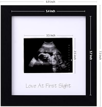 eletecpro Ultrasound Picture Frame with Glass Cover and 3 Mats 7x7 Baby Keepsake Frame for 3x4 Sonogram Photo Black