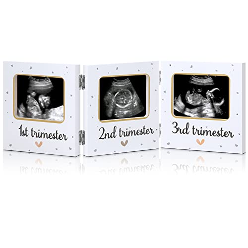 Amyhill Triple Ultrasound Baby Keepsake Frame White