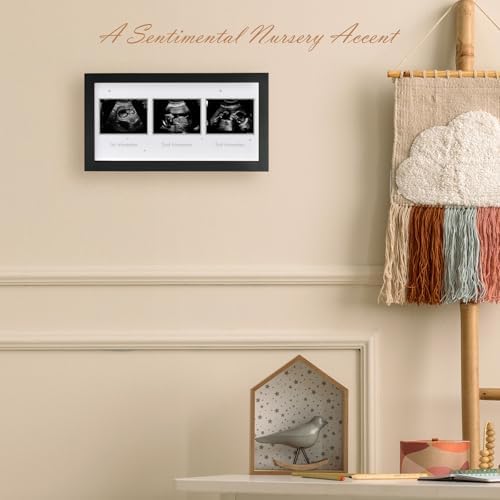 Triple Ultrasound Frame for Pregnancy Memories