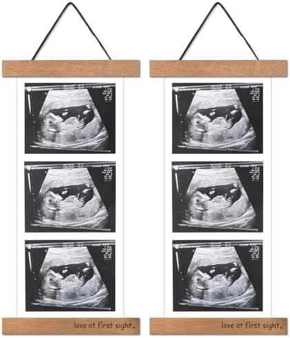 Zyeco 2 Pcs Ultrasound Picture Frame Wooden Magnetic for Refrigerator