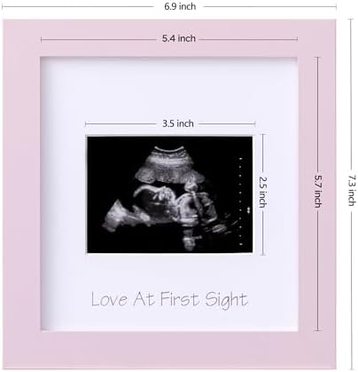 eletecpro Ultrasound Frame with 3 Mats and Real Glass Cover 7x7 Pink Keepsake
