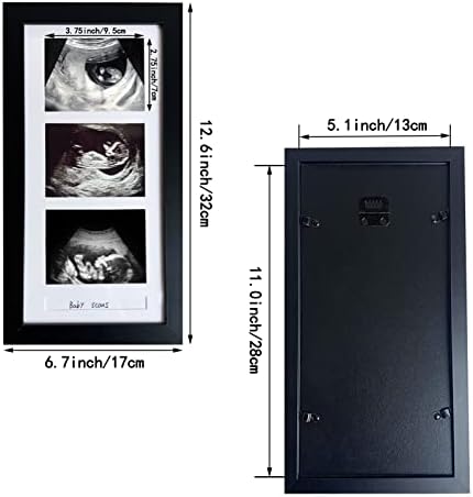 Triple Ultrasound Picture Frame with 3 Photos