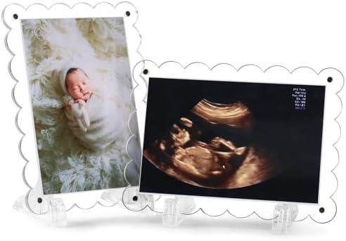 Mlatnod 2 Pack Magnetic Clear Acrylic Scalloped Ultrasound Frames with Stand