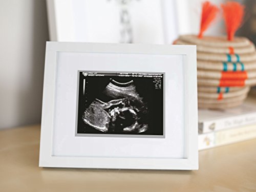 Pearhead Sonogram Frame White Shadowbox Baby Keepsake