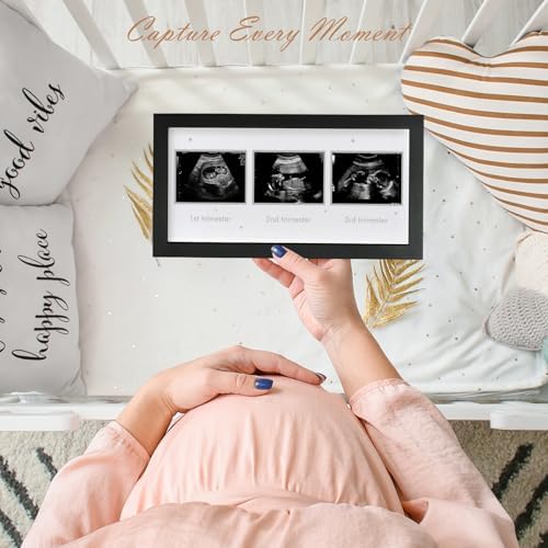 Triple Ultrasound Frame for Pregnancy Memories