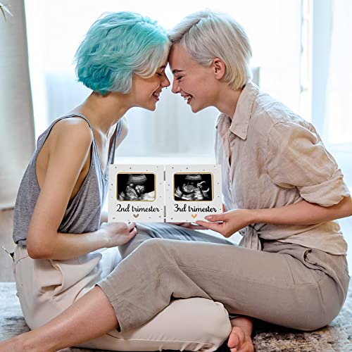 Amyhill Triple Ultrasound Baby Keepsake Frame White