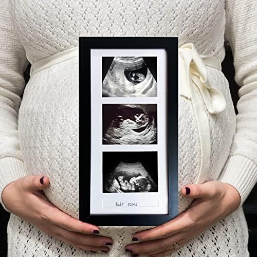 Triple Ultrasound Picture Frame with 3 Photos