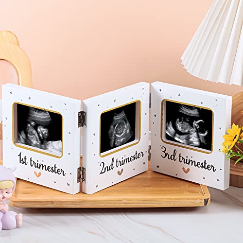 Amyhill Triple Ultrasound Baby Keepsake Frame White