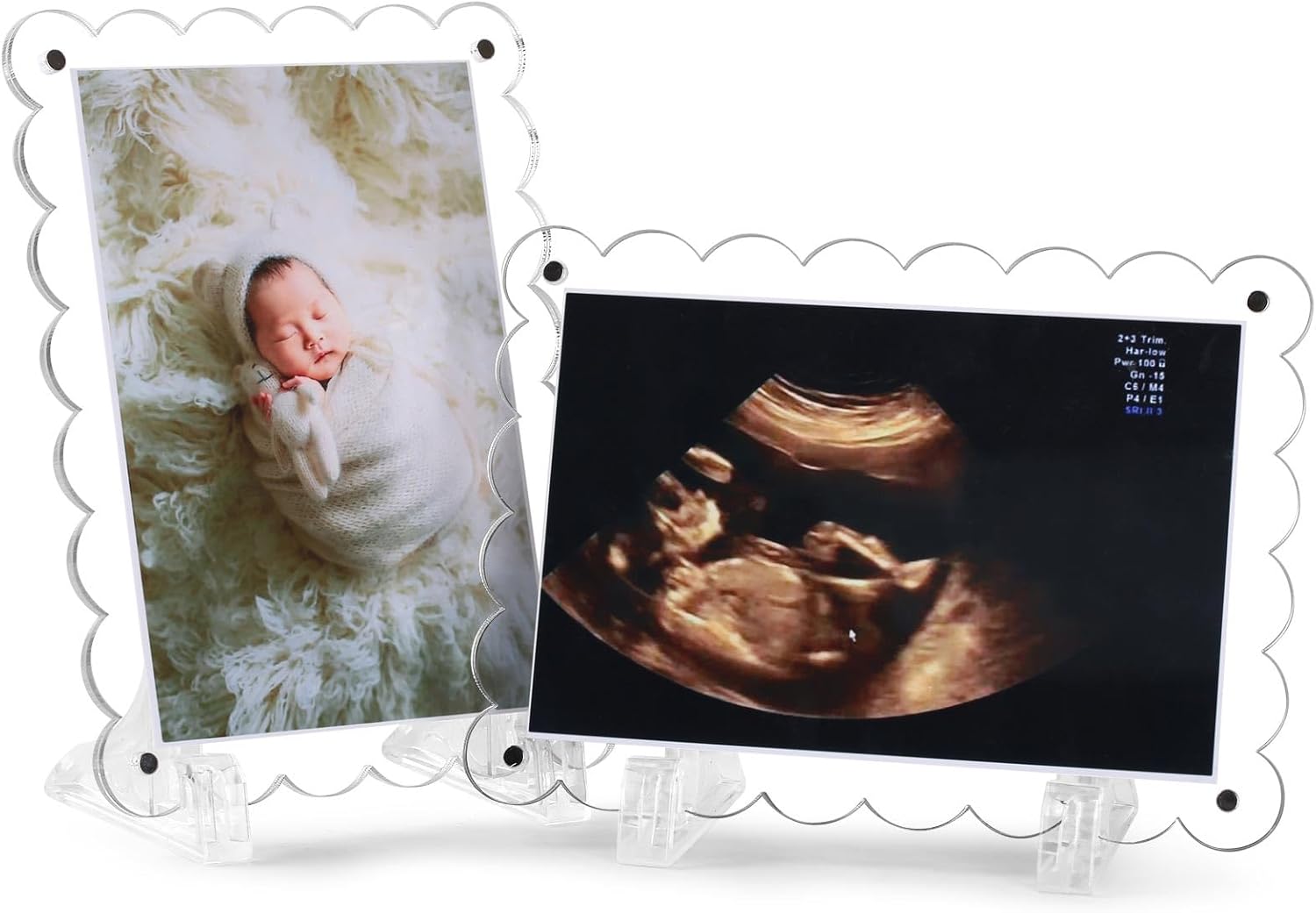Mlatnod 2 Pack Magnetic Clear Acrylic Scalloped Ultrasound Frames with Stand