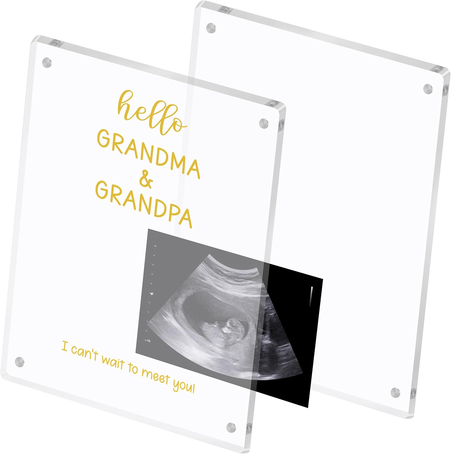 Blinking Stars Ultrasound Baby Announcement Frame