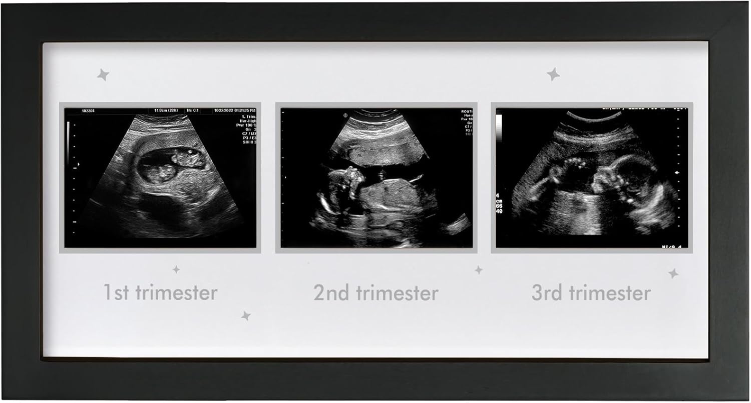 Triple Ultrasound Frame for Pregnancy Memories