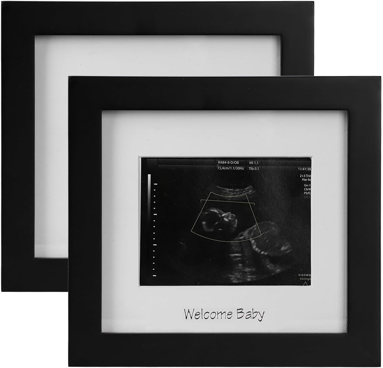 IHEIPYE Baby Sonogram Photo Frame 2Pack 1