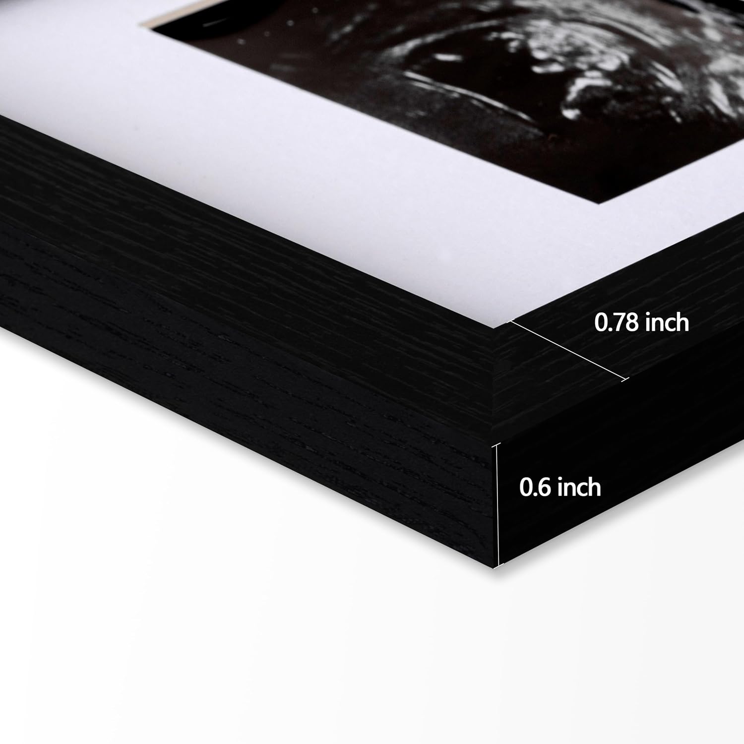 eletecpro Ultrasound Picture Frame with Glass Cover and 3 Mats 7x7 Baby Keepsake Frame for 3x4 Sonogram Photo Black