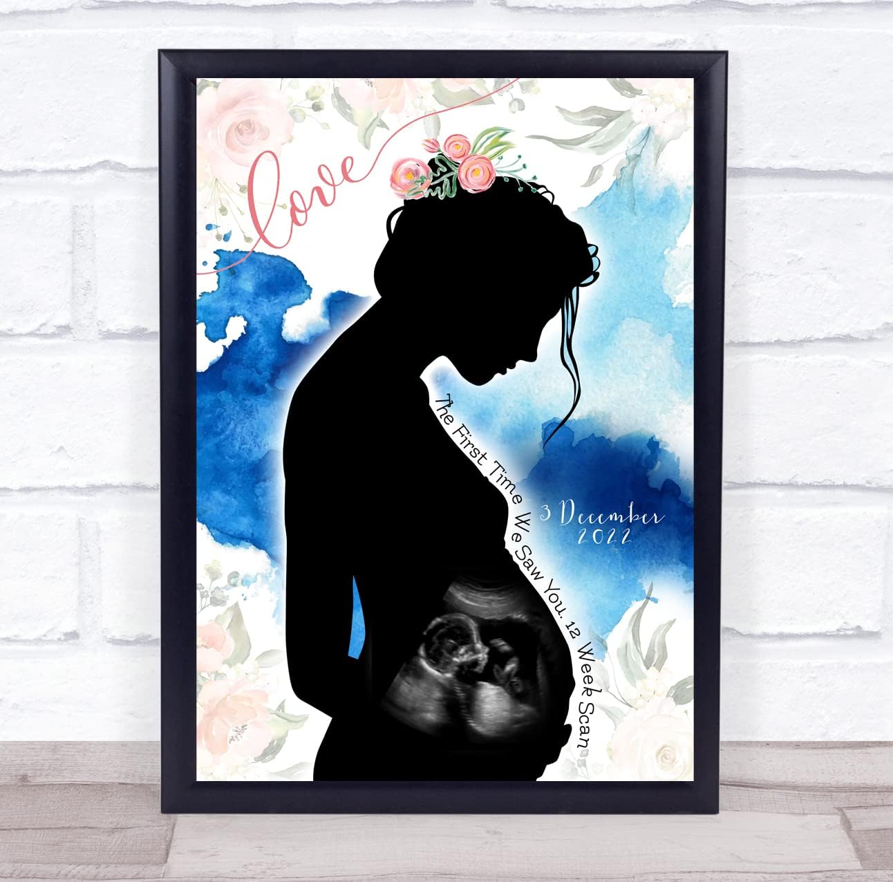 Pregnancy Lady Silhouette Baby Scan Art Print