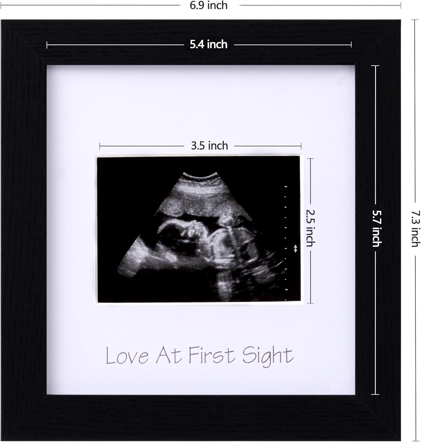 eletecpro Ultrasound Picture Frame with Glass Cover and 3 Mats 7x7 Baby Keepsake Frame for 3x4 Sonogram Photo Black