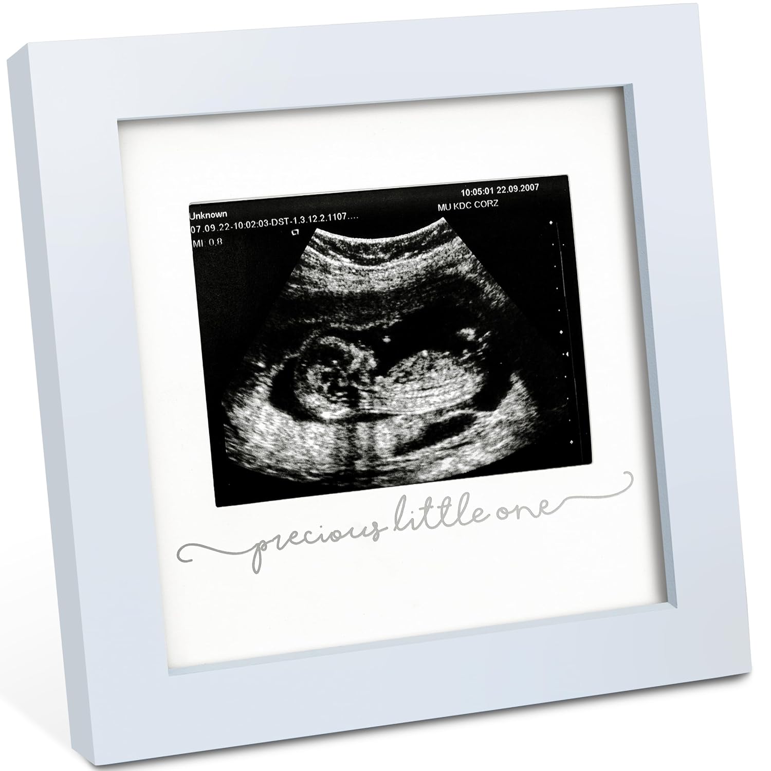 KeaBabies Baby Sonogram Picture Frame - Mist Blue 1