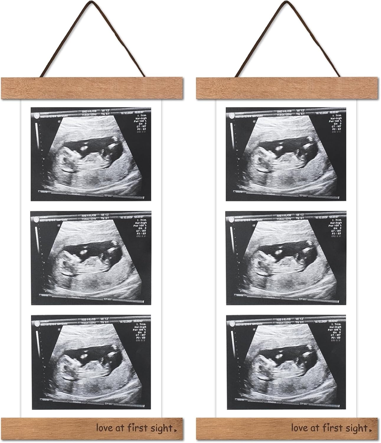 Zyeco 2 Pcs Ultrasound Picture Frame Wooden Magnetic for Refrigerator