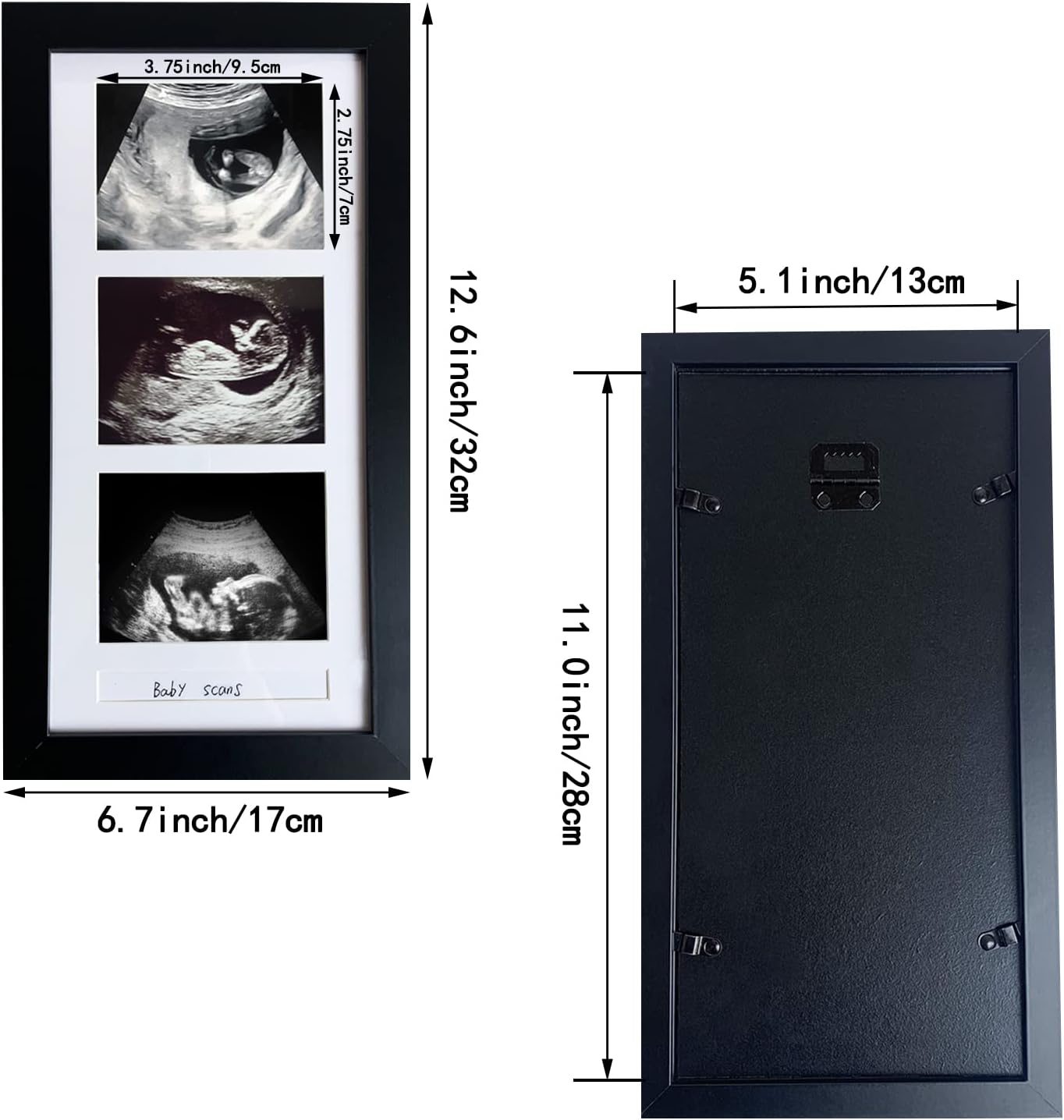 Triple Ultrasound Picture Frame with 3 Photos