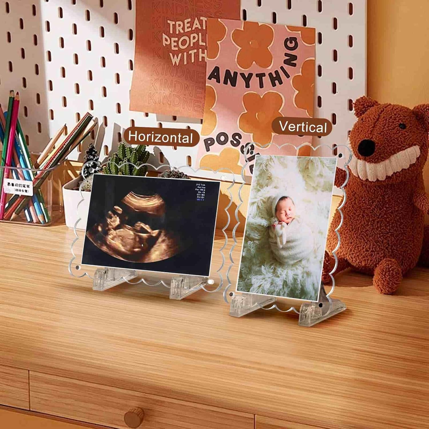 Mlatnod 2 Pack Magnetic Clear Acrylic Scalloped Ultrasound Frames with Stand