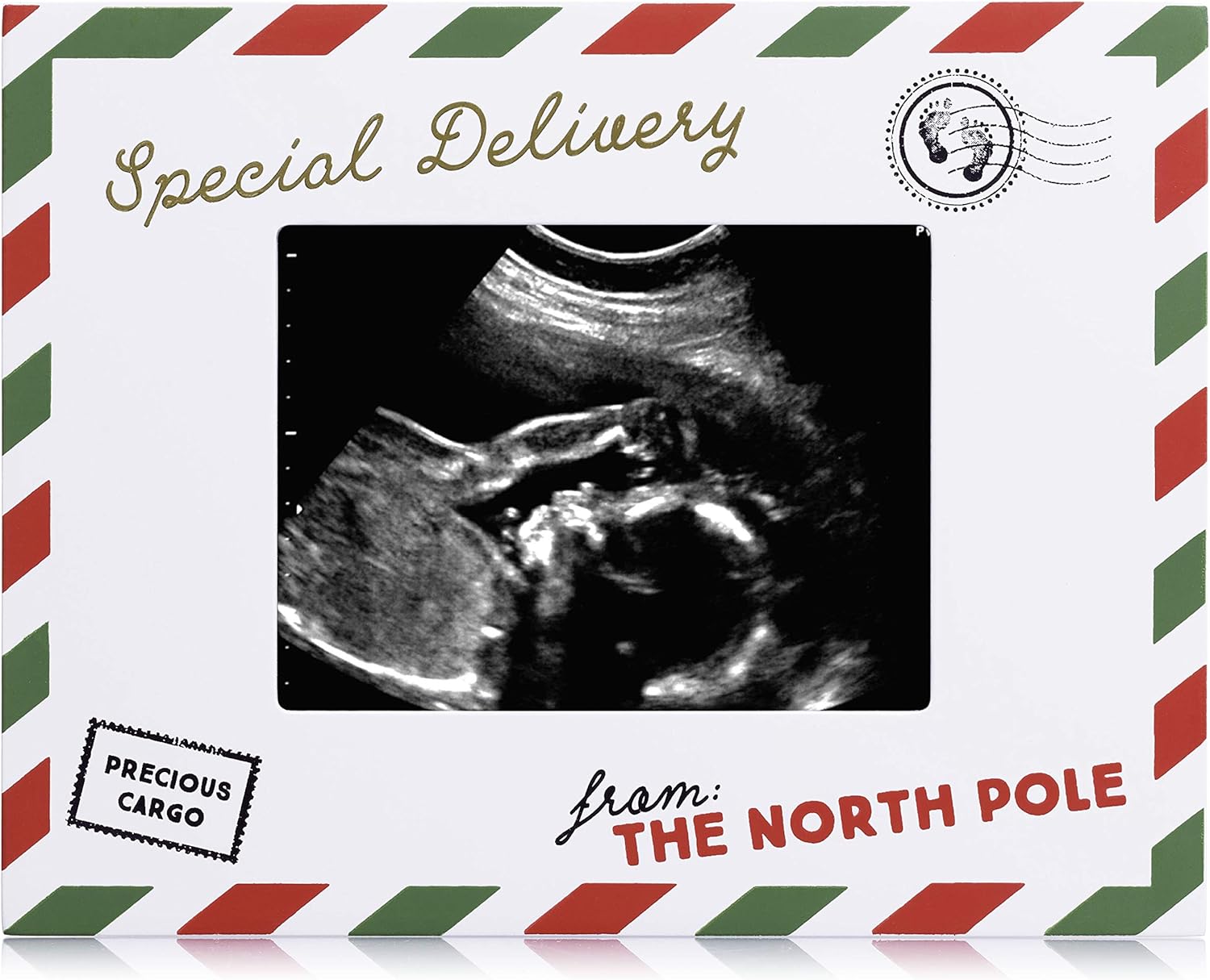 Pearhead Holiday Sonogram Frame with Easel and Hanger